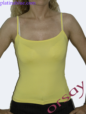 Orsay sárga női ruha fotója